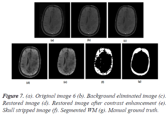 biomedres-contrast-enhancement