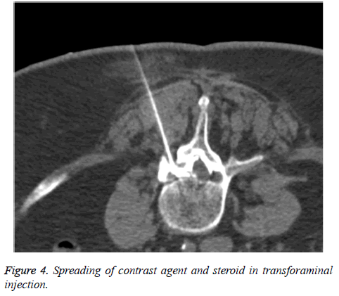 biomedres-contrast-steroid