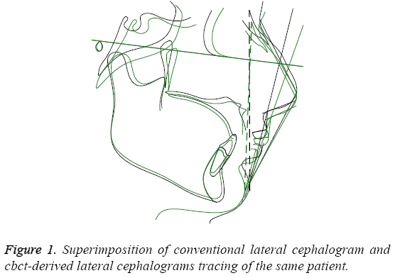 biomedres-conventional-lateral-cephalogram