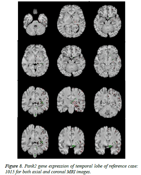 biomedres-coronal-MRI-images