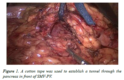 biomedres-cotton-tape-tunnel