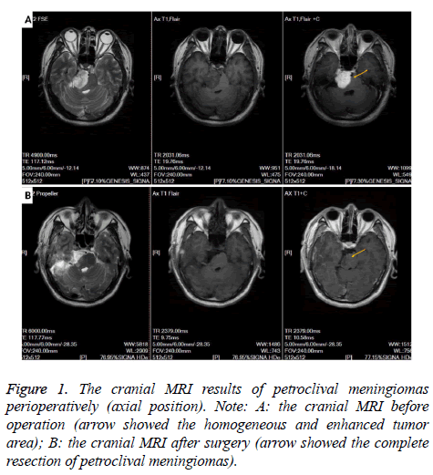 biomedres-cranial-MRI