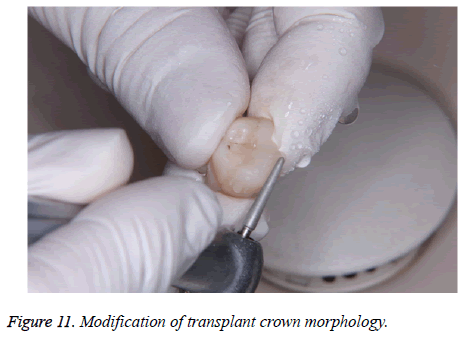 biomedres-crown-morphology