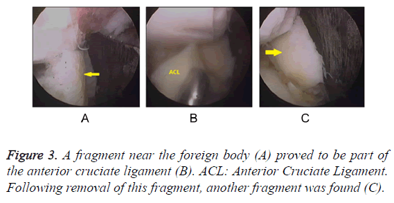 biomedres-cruciate-ligament