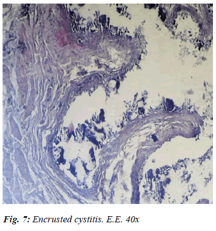 biomedres-cystitis