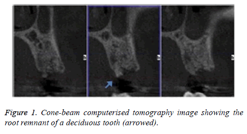 biomedres-deciduous-tooth