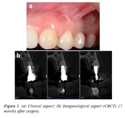 biomedres-deciduous-tooth