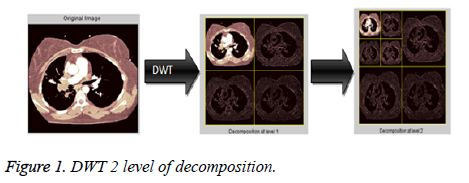 biomedres-decomposition