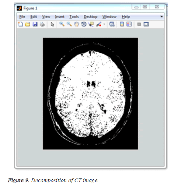 biomedres-decomposition-CT-image