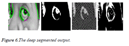 biomedres-deep-segmented