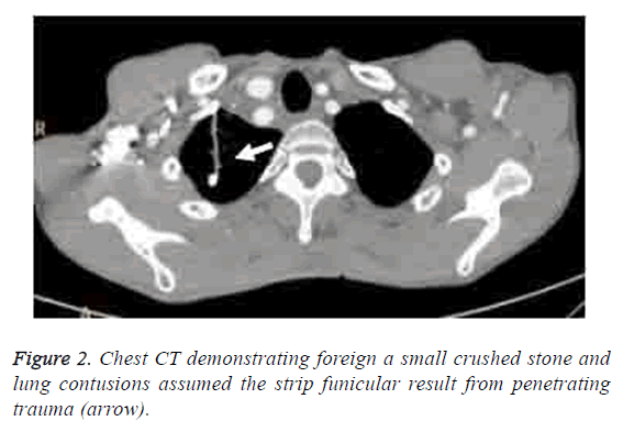 biomedres-demonstrating-foreign