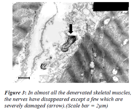 biomedres-denervated-skeletal-muscles