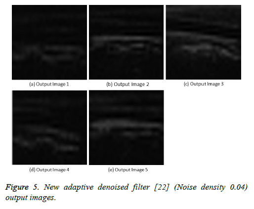 biomedres-denoised-filter