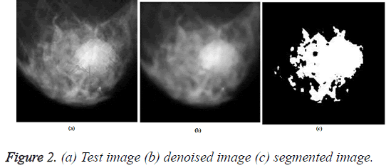 biomedres-denoised-image