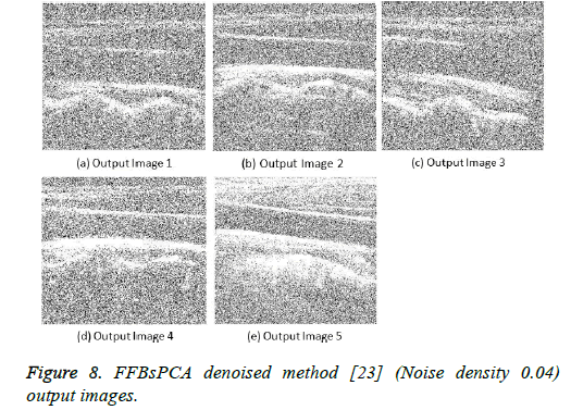 biomedres-denoised-method