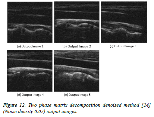 biomedres-denoised-method