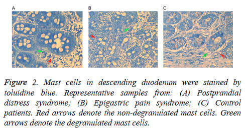 biomedres-descending-duodenum