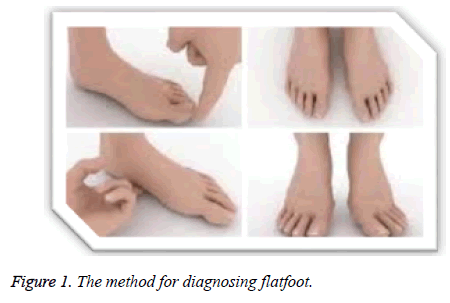 biomedres-diagnosing-flatfoot