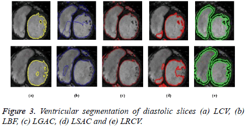 biomedres-diastolic-slices