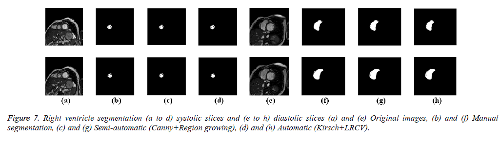 biomedres-diastolic-slices