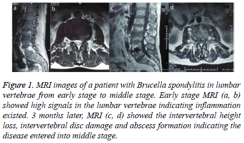 biomedres-disease-formation