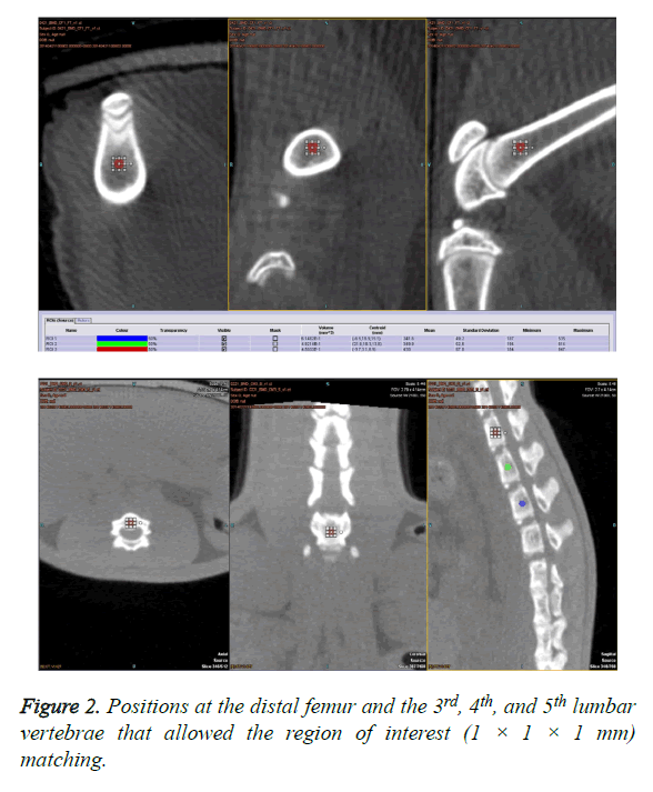 biomedres-distal-femur