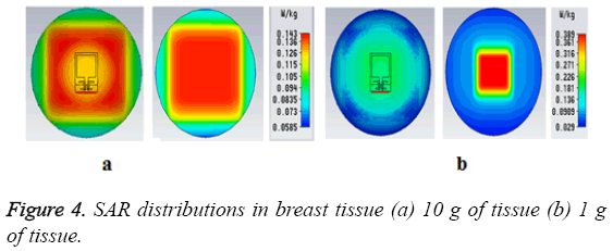 biomedres-distributions-breast-tissue