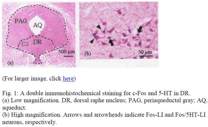 biomedres-dorsal-raphe-nucleus