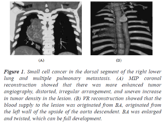 biomedres-dorsal-segment