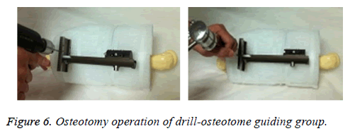 biomedres-drill-osteotome