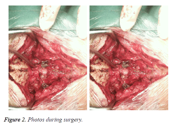 biomedres-during-surgery