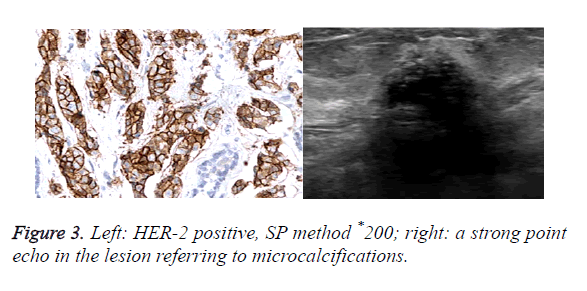 biomedres-echo-lesion