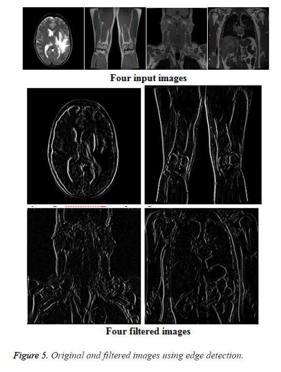 biomedres-edge-detection