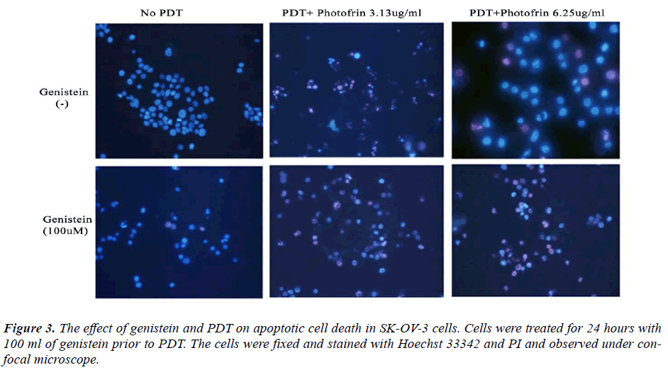 biomedres-effect-genistein-PDT