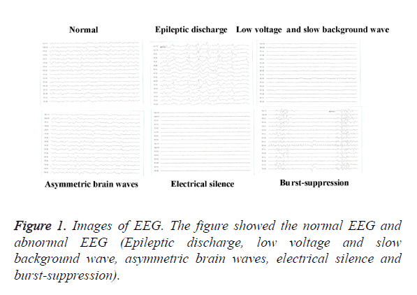 biomedres-electrical-silence