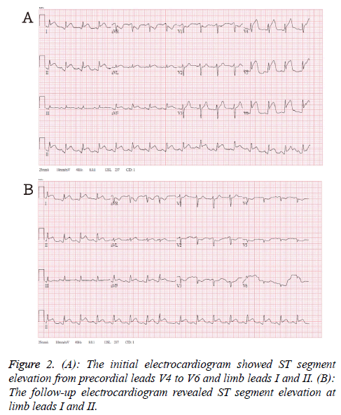 biomedres-electrocardiogram