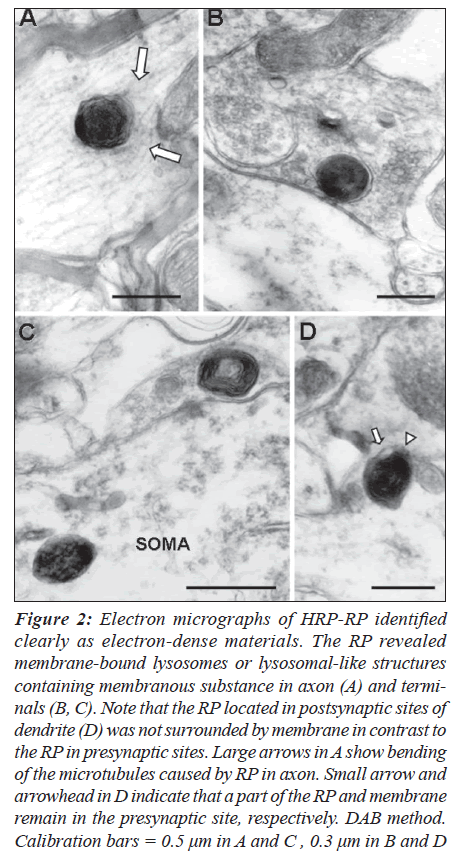 biomedres-electron-dense-axon-presynaptic