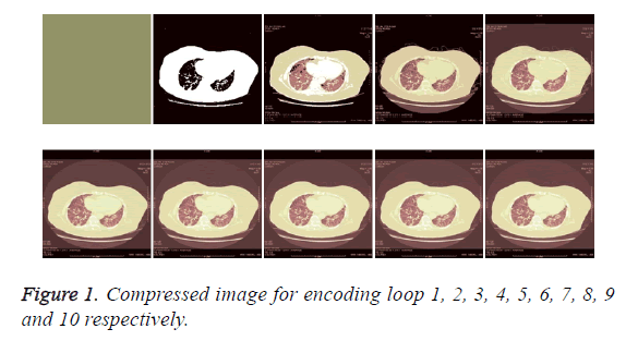 biomedres-encoding-loop