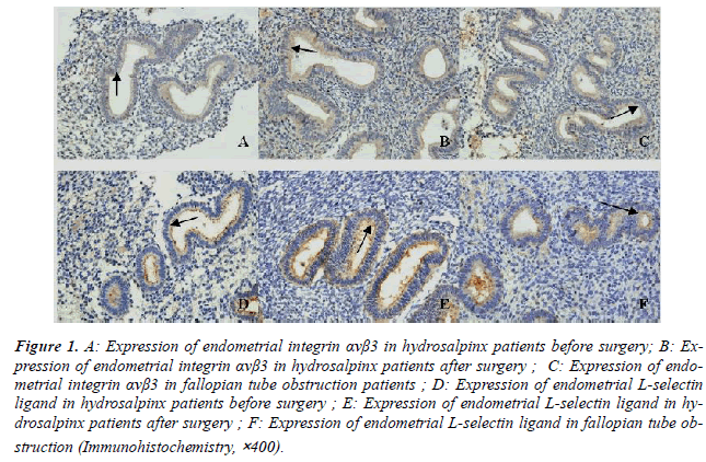 biomedres-endometrial-integrin