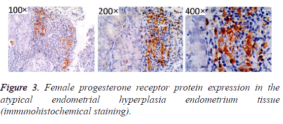 biomedres-endometrium-tissue