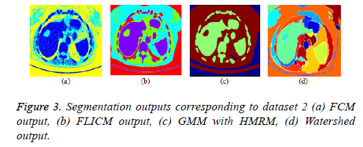 biomedres-entropy-dataset