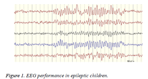 biomedres-epileptic-children