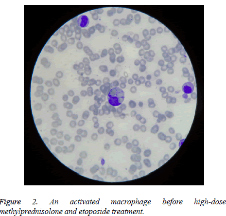 biomedres-etoposide-treatment