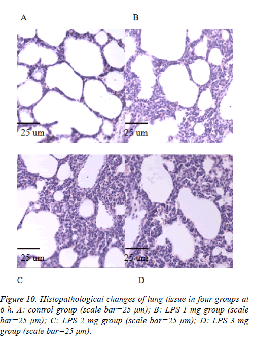 biomedres-expression-lung