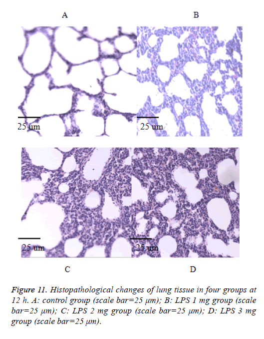 biomedres-expression-lung