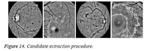 biomedres-extraction-procedure