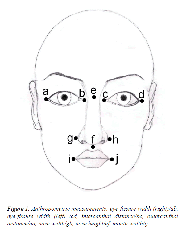 biomedres-eye-fissure