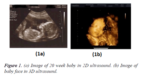 biomedres-face-3D-ultrasound