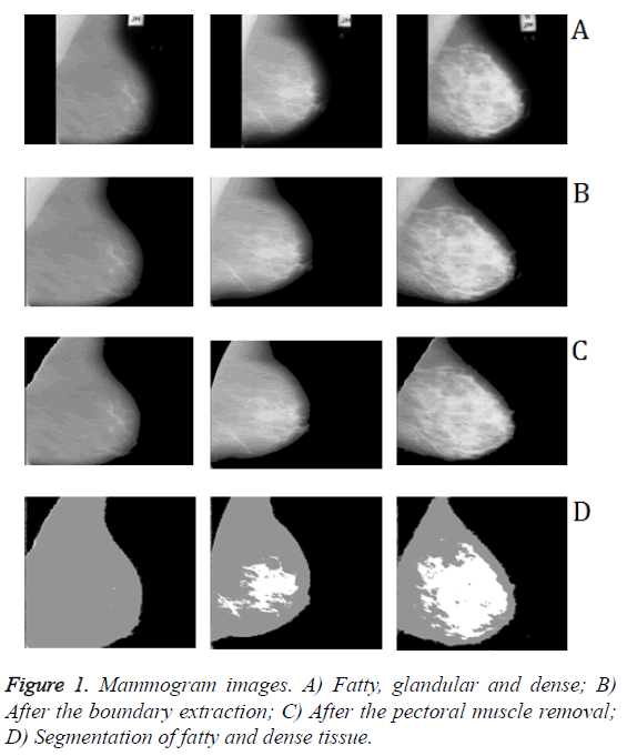 biomedres-fatty-dense-tissue