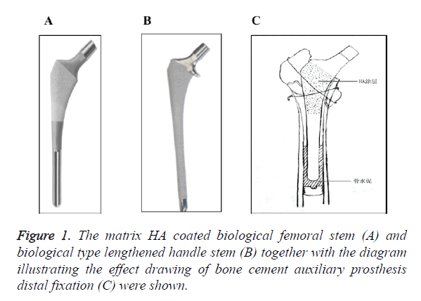 biomedres-femoral-stem